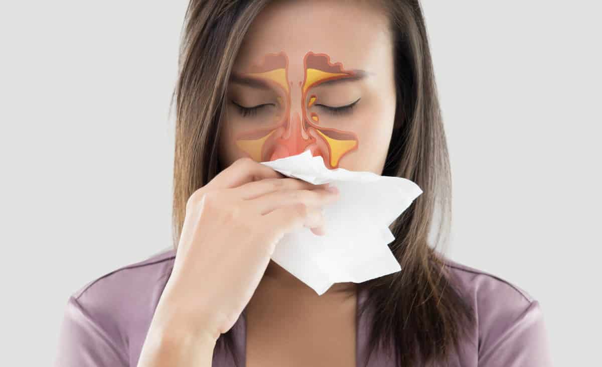 Biofilms In Treating Chronic Sinusitis - Sinus Infection | The ID Doc